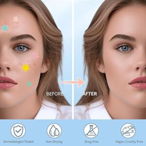 Pimple Patches for Face, Hydrocolloid Acne Patches, Cute Star Zit Covers, Colorful Spot Stickers with Tea Tree, Salicylic Acid & Cica Oil| 3 Sizes (10mm, 12mm & 14mm) |200 Count