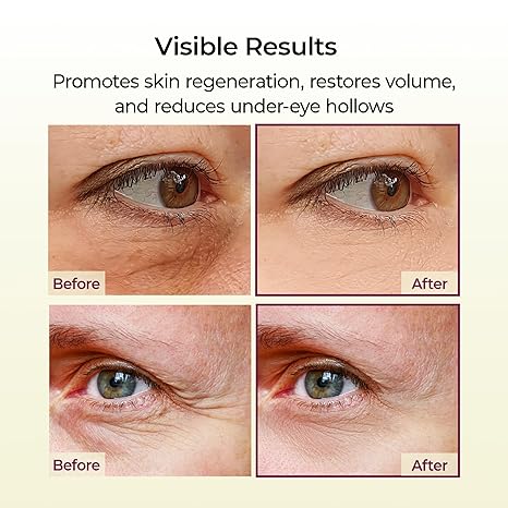 Dr.Melaxin Cemenrete Calcium Multi Balm 9g Korean Skin Care All In One Calcium Volume Stick Collagen Wrinkles Face Eye treatment Balm - Image 2